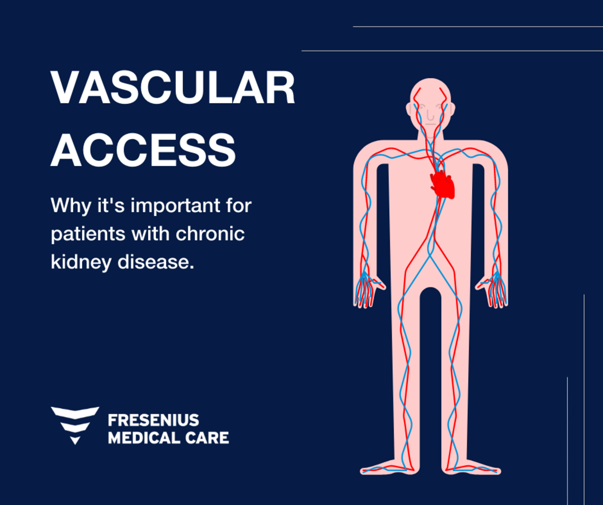 Nephrocare News / Our work on vascular access preservation in